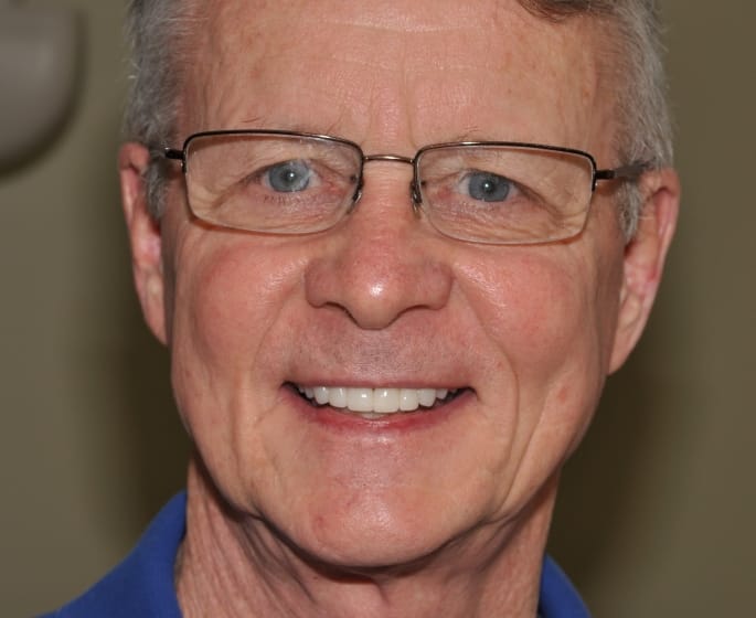 Sparkling Smiles Fayetteville Before and After man portrait