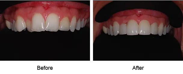 Smile Galley Before and After
