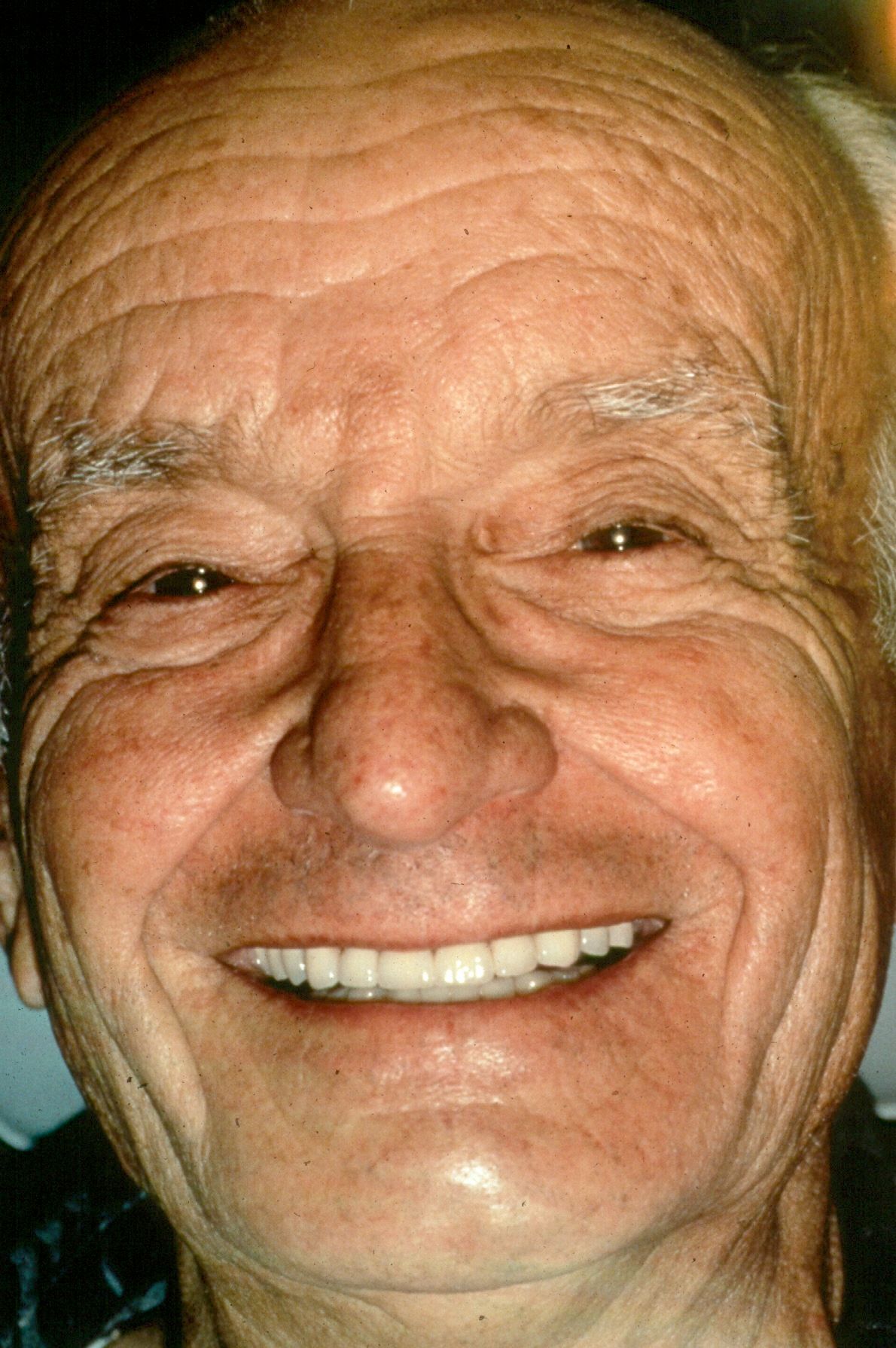 Rasner Smile gallery after 19