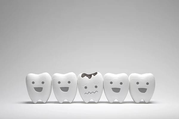 Row of five toy teeth, all smiling except for the middle tooth which frowns because of tooth decay Row of five toy teeth, all smiling except for the middle tooth which frowns because of tooth decay