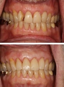 Before & After Walding and Associates