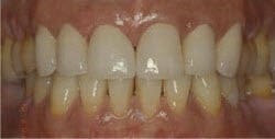 Patient 25634 After Photo