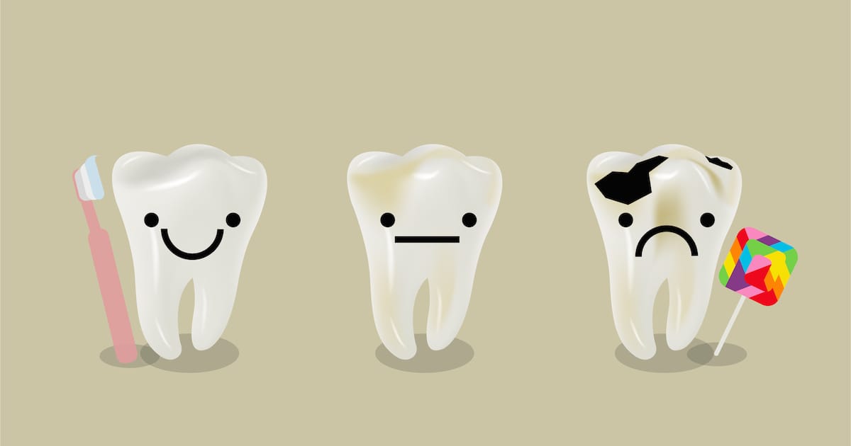 Bleaching - Great Choices To Brighten Your Child's Smile