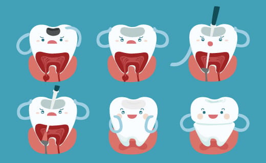 How a Root Canal Can Save a Decayed or Infected Tooth