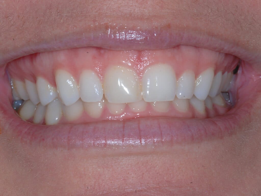 Virginia DC case 75 before