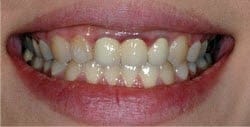 Patient 76610 Before Photo