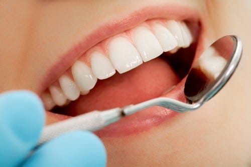 What is a Dental Crown?