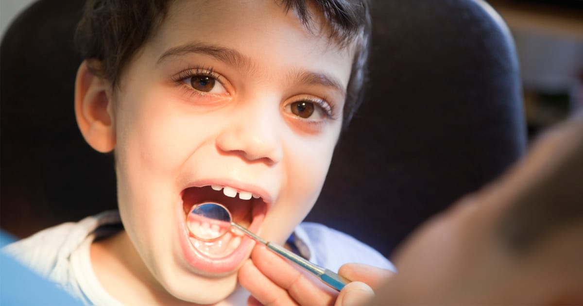 The Biting Truth About Dental Cavities in Children The Biting Truth About Dental Cavities in Children