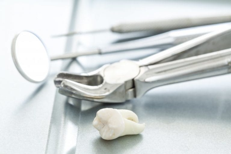 What Does Tooth Extraction Feel Like What Does Tooth Extraction Feel Like