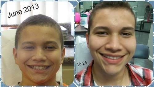 Before and after