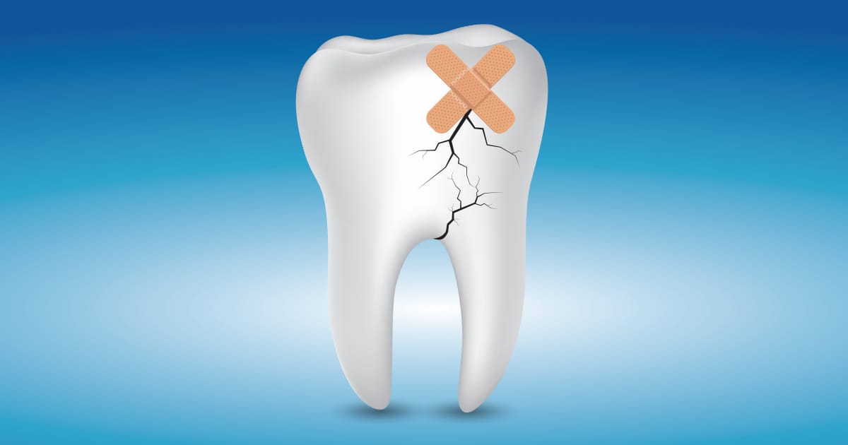Get that Knocked-out Tooth to a Good Affordable Dentist Get that Knocked-out Tooth to a Good Affordable Dentist