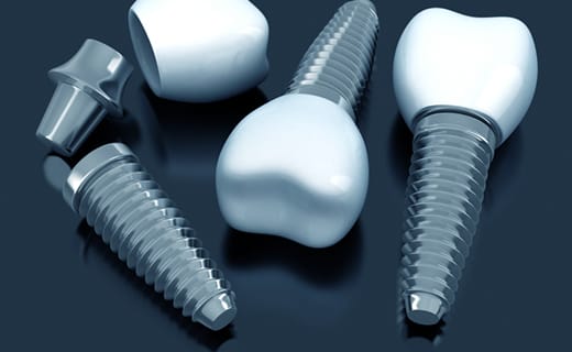 How Dental Implants Can Restore Your Smile How Dental Implants Can Restore Your Smile