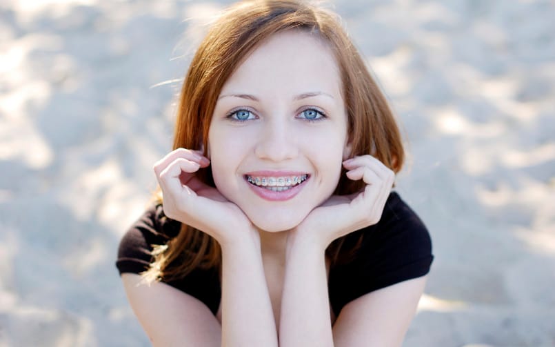 Taking Care of Your Braces