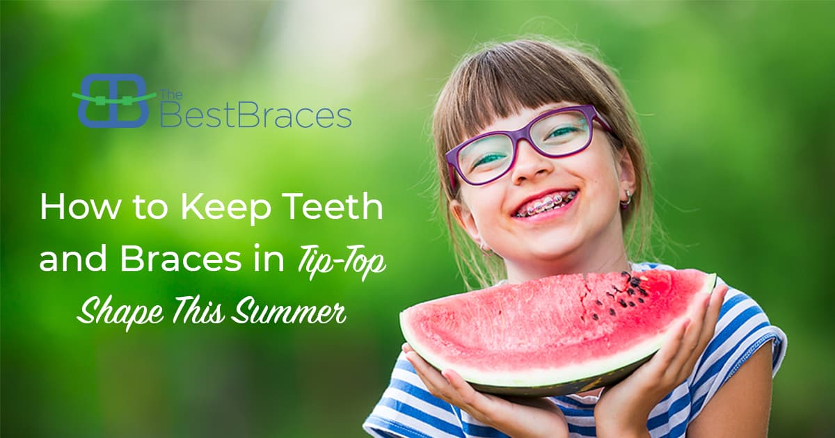 How To Keep Teeth And Braces In Tip-Top Shape This Summer How To Keep Teeth And Braces In Tip-Top Shape This Summer