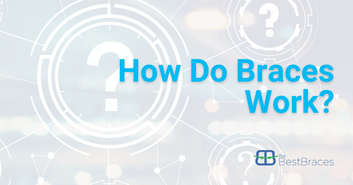 How Do Braces Work? How Do Braces Work?
