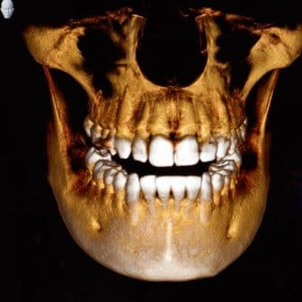 3D-dental-imaging