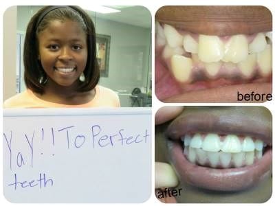 Before and after