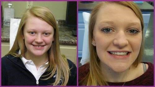 Before and after
