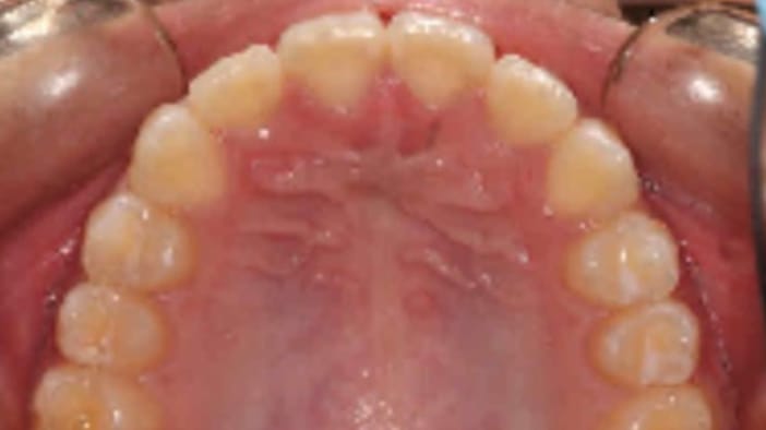 BF Ortho Smile Gallery After