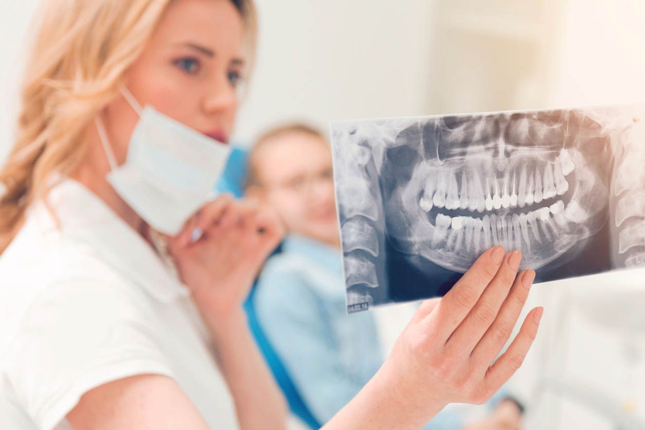 Wisdom teeth X-ray image Wisdom teeth X-ray image