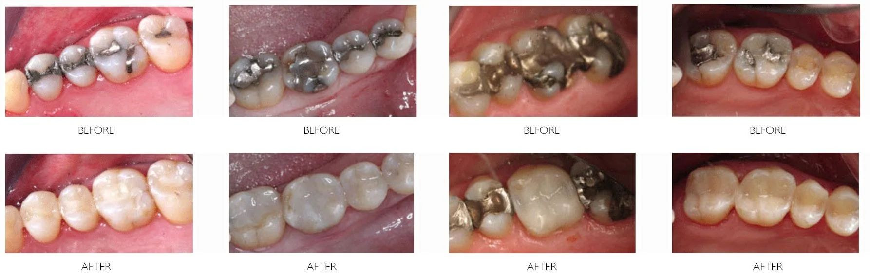 Helfner Services Restore Before & After