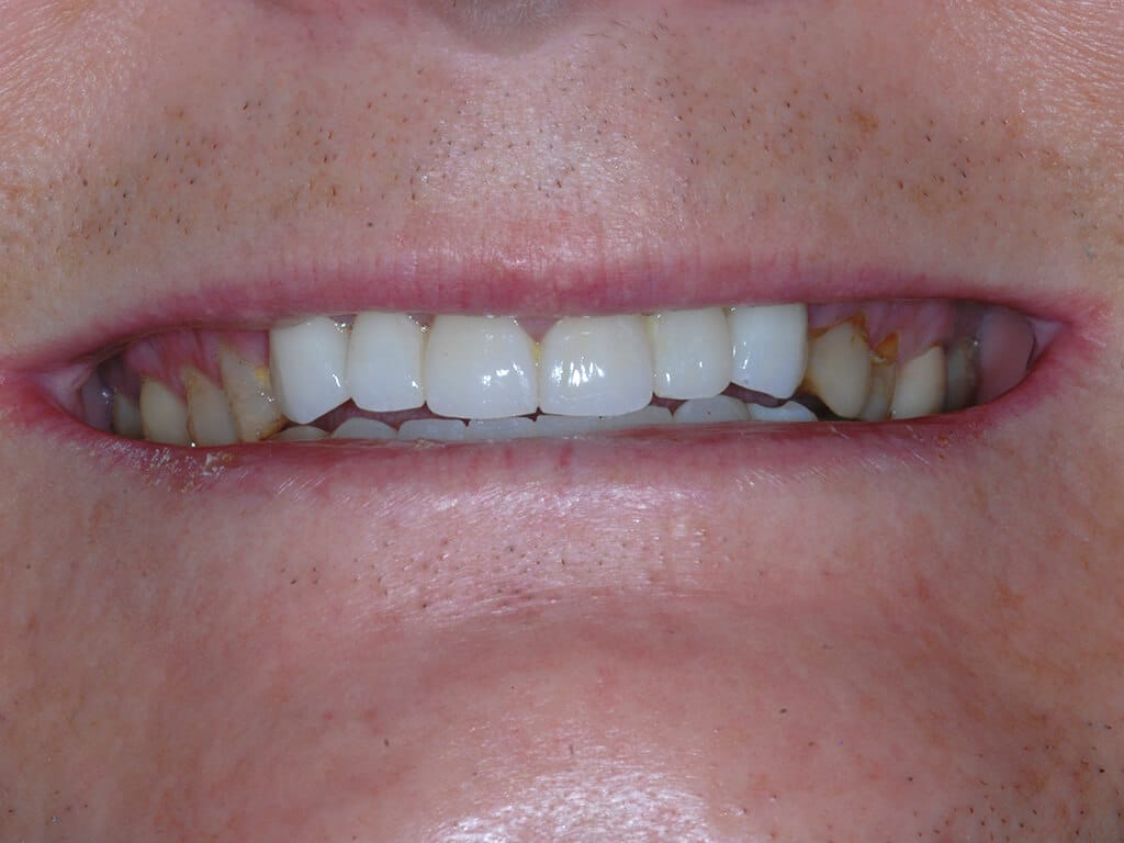 Virginia DC case 78 after
