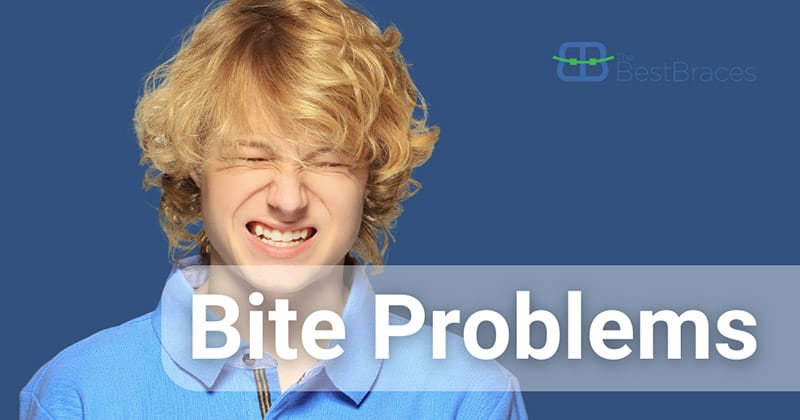 Best Braces Bite Problems Best Braces Bite Problems
