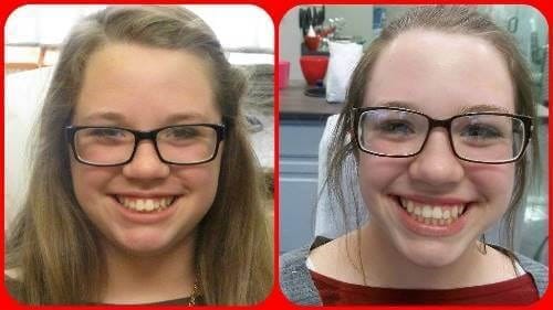 Before and after