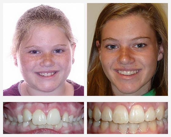Smile Gallery Photo 4