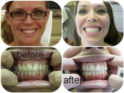 Before and after
