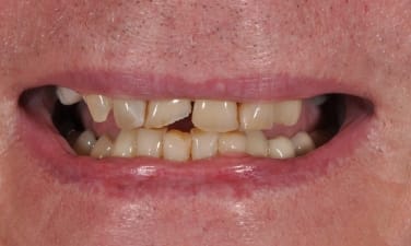Sparkling Smiles Fayetteville Before image