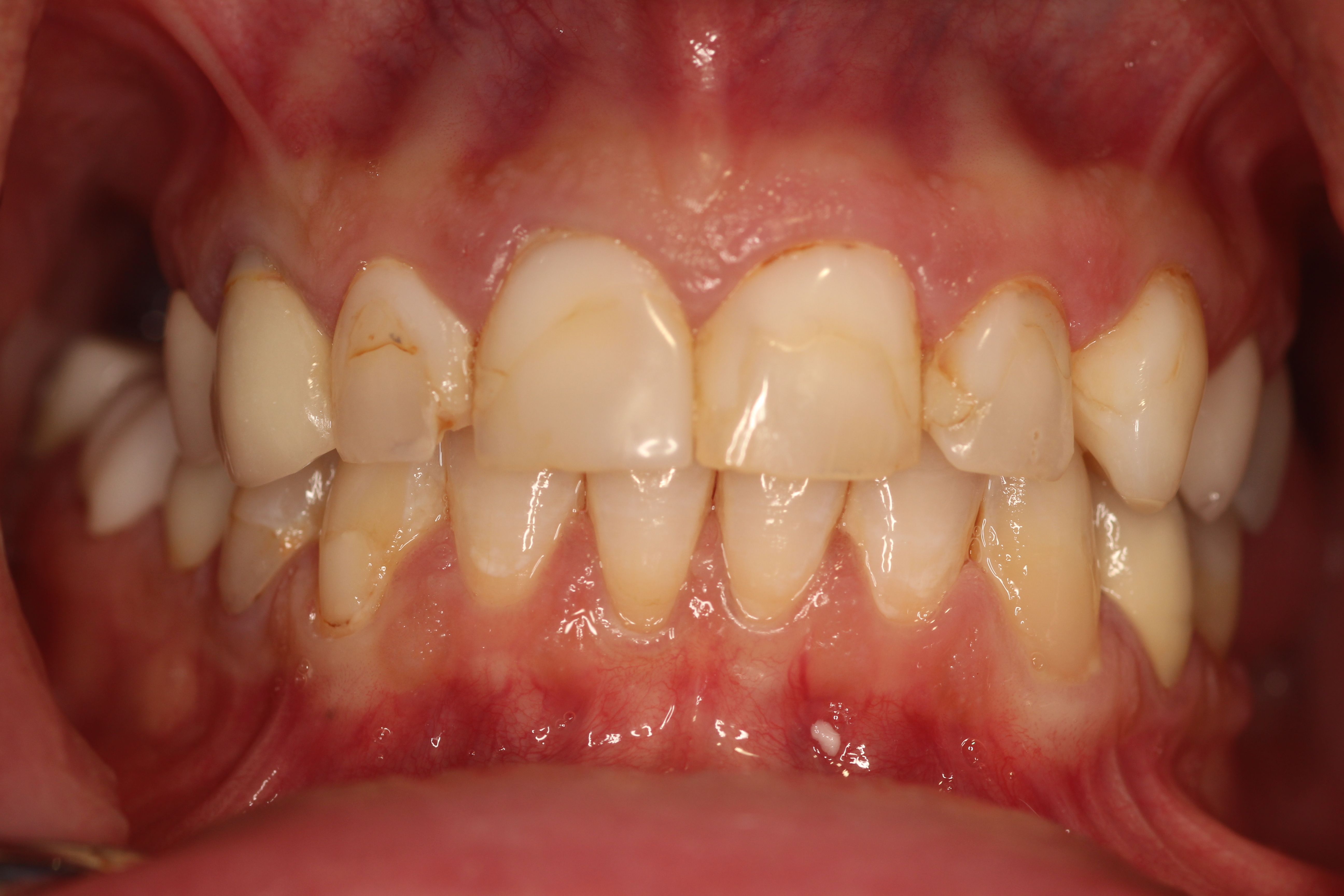 Rasner Smile gallery before 8