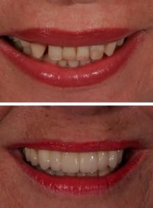 Before & After Walding and Associates