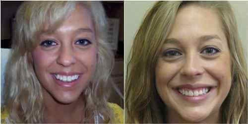 Before and after