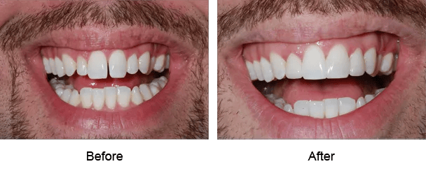 Smile Galley Before and After