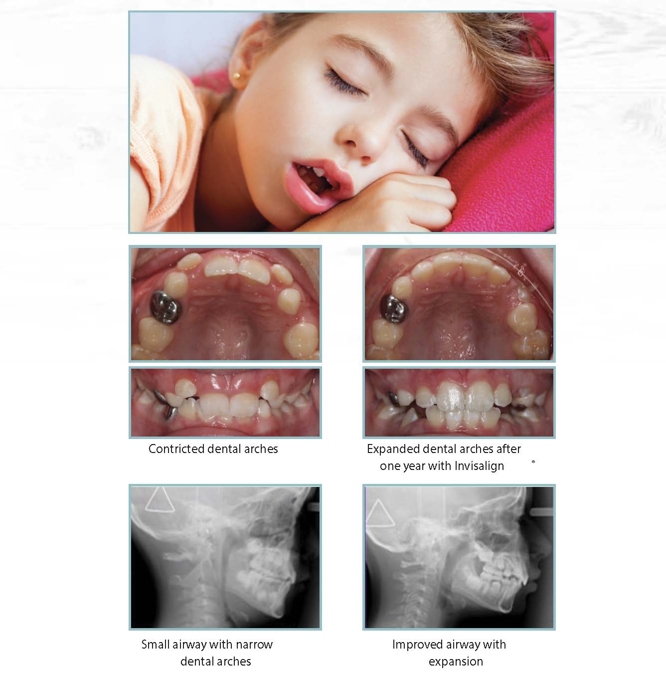 BF Ortho Airway Orthodontics service image