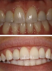 Before & After Walding and Associates