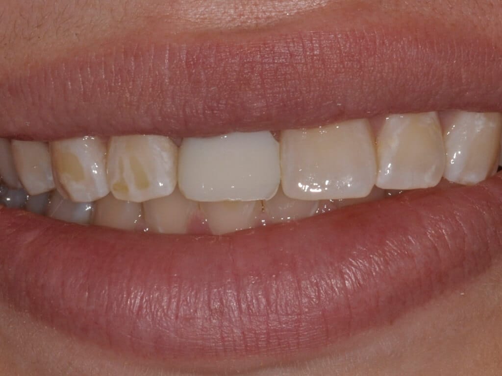 Virginia DC case 74 before