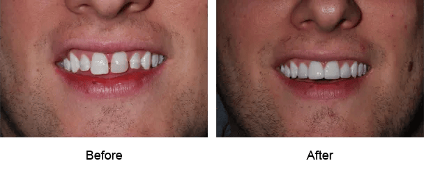 Smile Galley Before and After