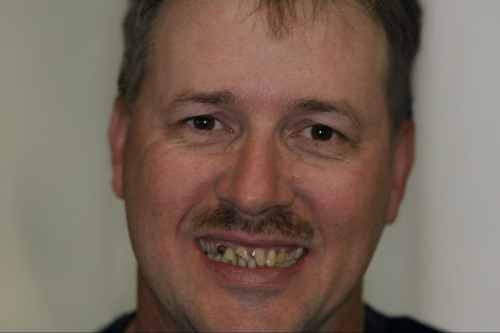 Rasner Smile gallery before 12