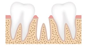 Image of Poor Oral Health Care