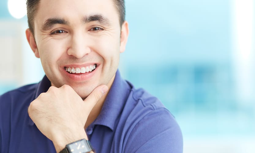 Adult Braces Adult Braces