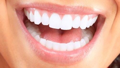 Nice Smile Nice Smile