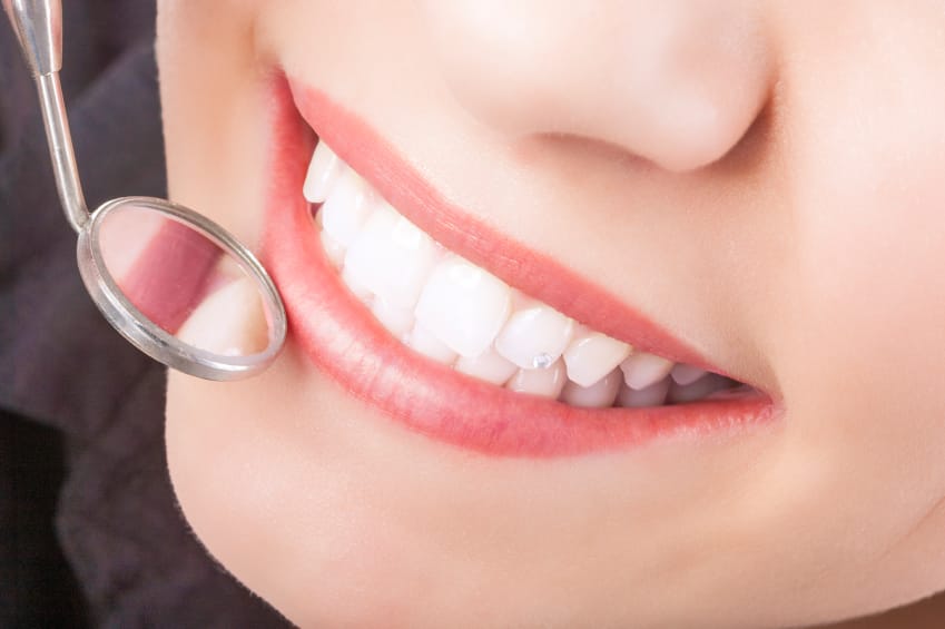 Dental Sealants