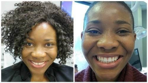Before and after