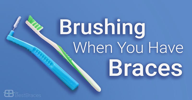 Best Braces Brushing When You Have Braces Best Braces Brushing When You Have Braces