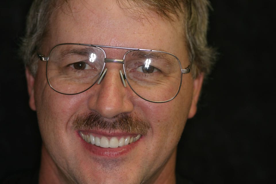Rasner Smile gallery after 12