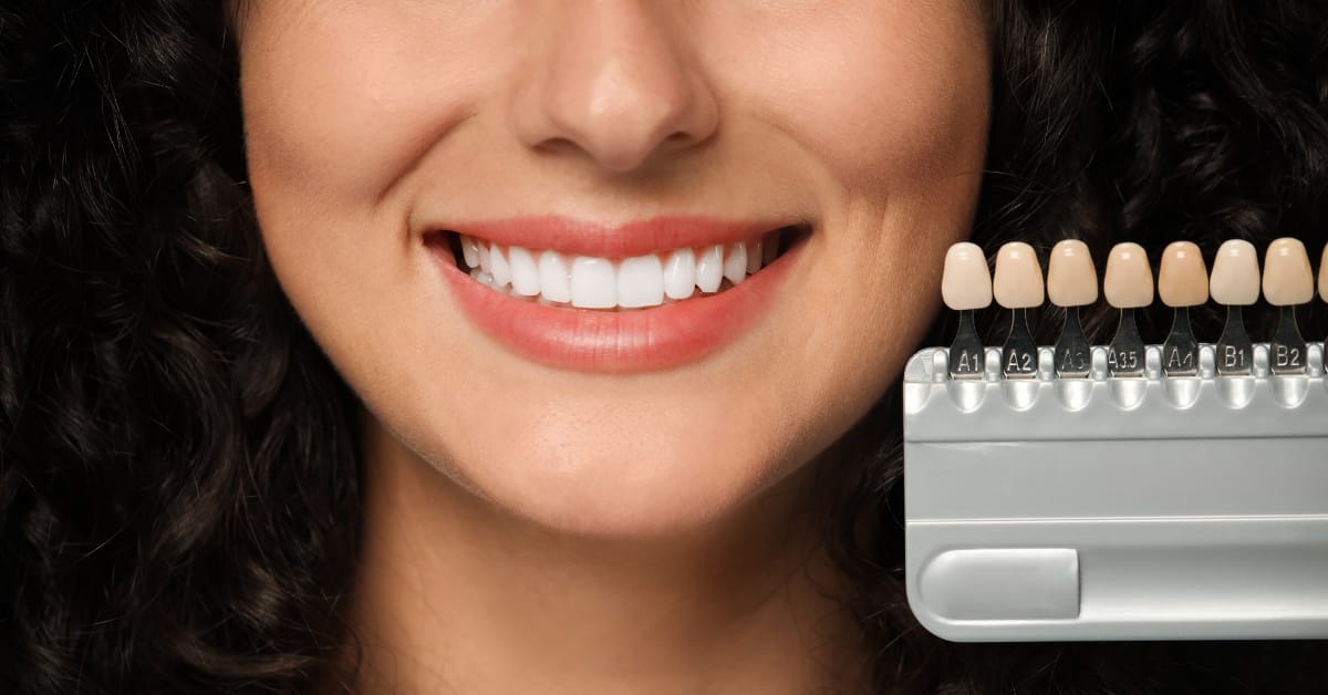 From Celebrities to Everyday Patients, Why Everyone's Getting Cosmetic Dental Work