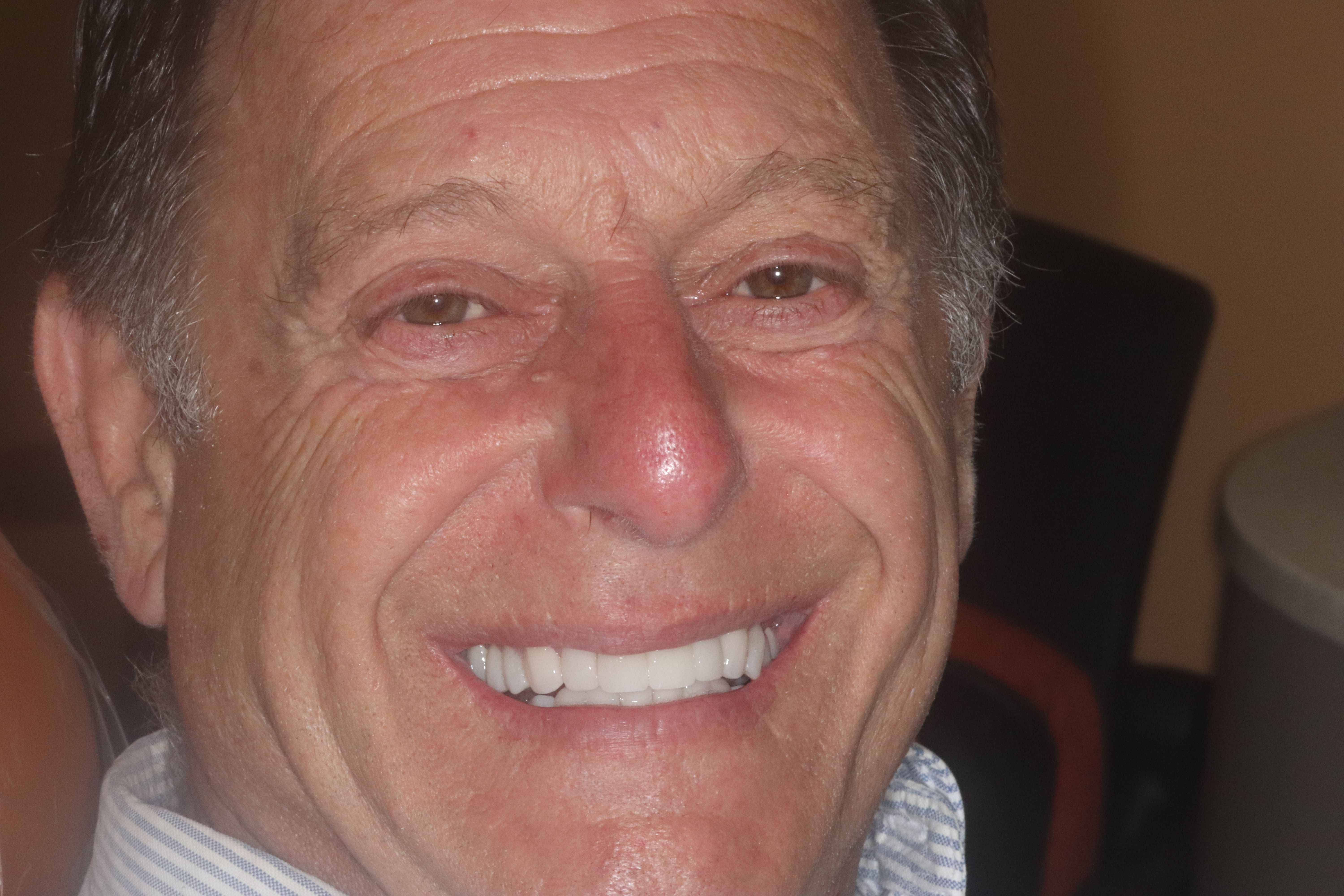 Rasner Smile gallery after 2