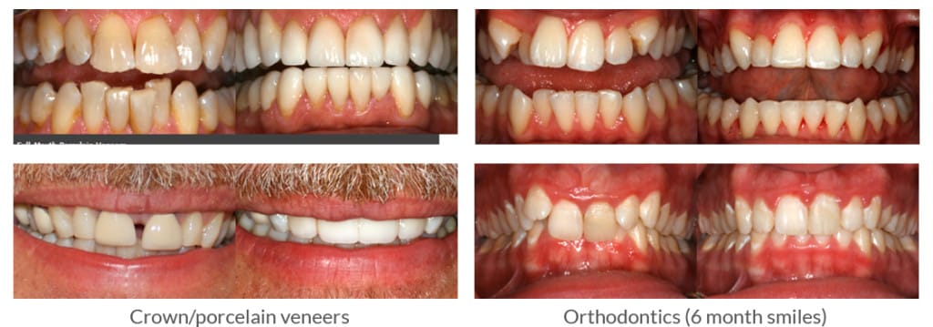 ldc cases